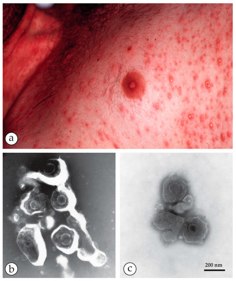 Viruses | Free Full-Text | Rapid Viral Diagnosis of Orthopoxviruses by ...