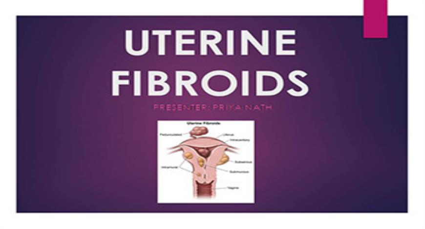 Download Free Medical Uterine Fibroids PowerPoint Presentation