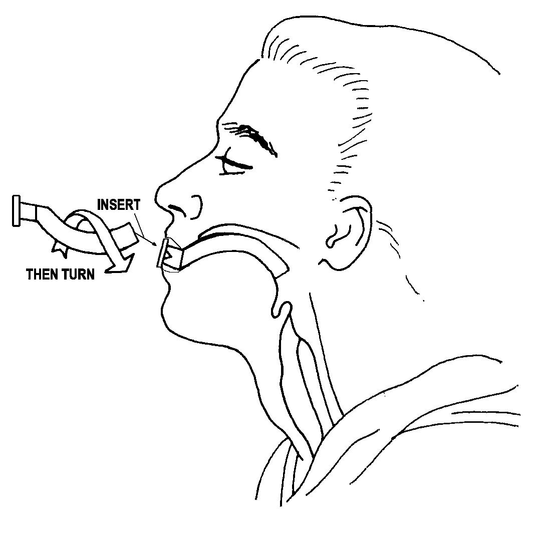 Oropharyngeal Airway Measurement