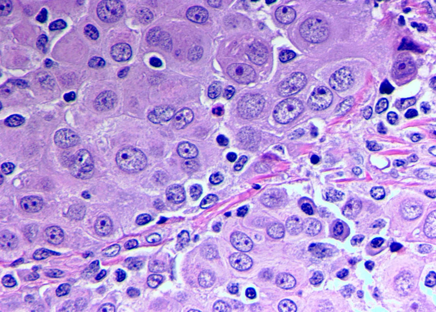 Mesothelium Histology