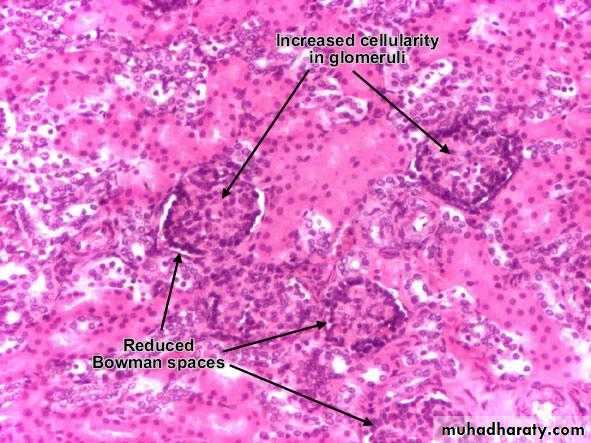 hematuria pptx - فرح - Muhadharaty