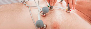 Electrocardiogram Electrodes