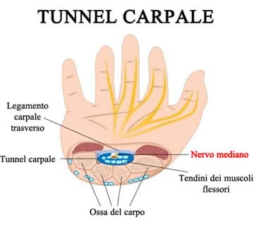 Tunnel Carpale