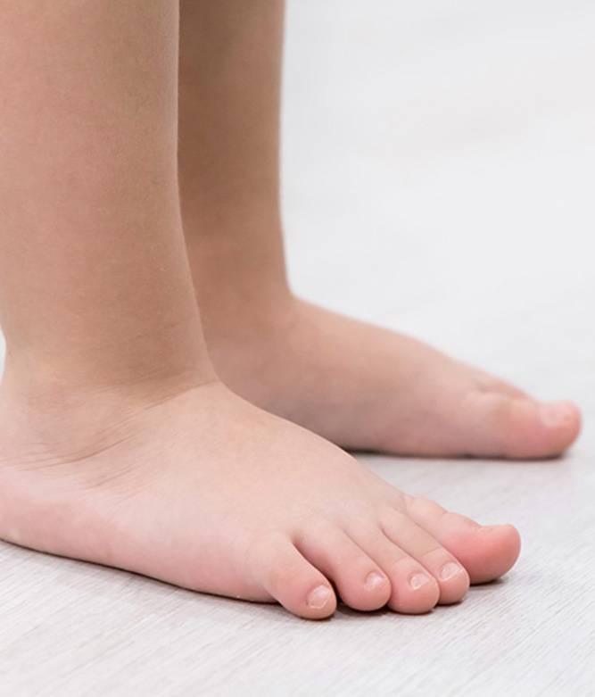 Children Flat Feet