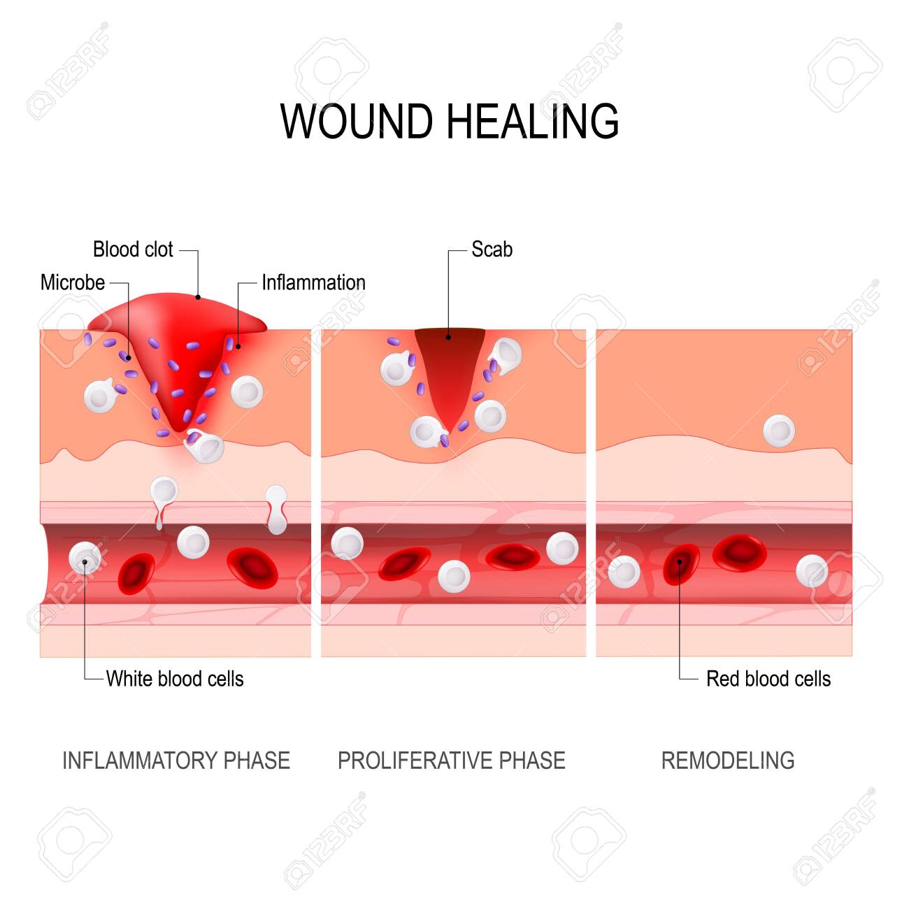 Wound Healing Process Diagram