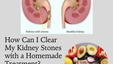 How Can I Clear My Kidney Stones with a Homemade Treatment