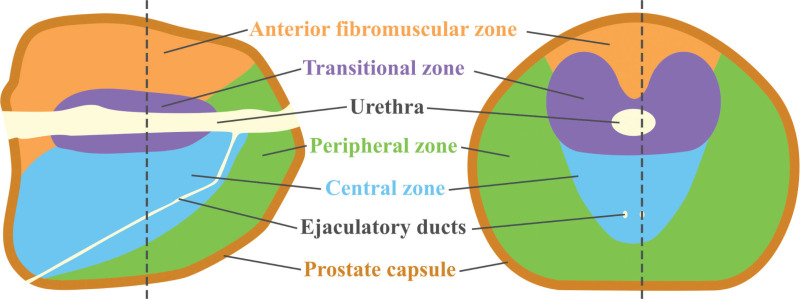 Prostate Zonal Anatomy Anatomical Charts Posters - vrogue.co