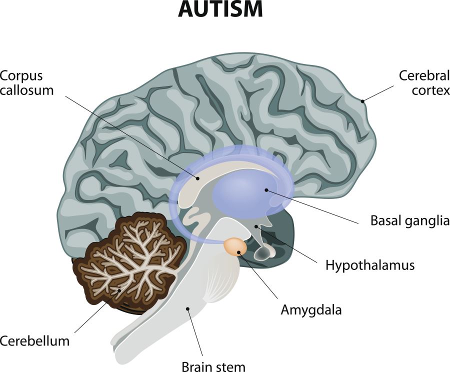 Labeled Brain Amygdala