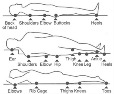 Pressure Damage Prevention and how to Care for your Skin - North Tees ...