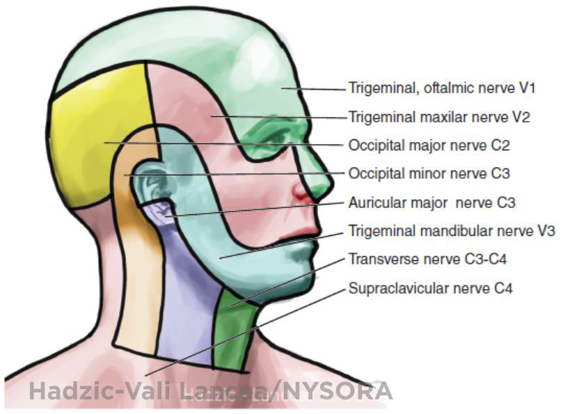 Cervical Plexus Block Landmarks And Nerve Stimulator Technique Nysora ...