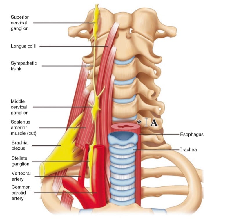 Ultrasound-Guided Cervical Sympathetic Block - NYSORA