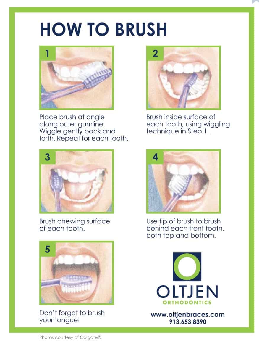 Good Oral Hygiene Is Important - Oltjen Orthodontics