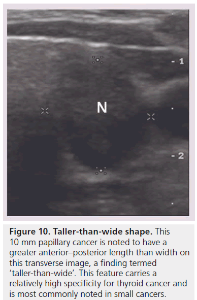 imaging-in-medicine-anterior–posterior