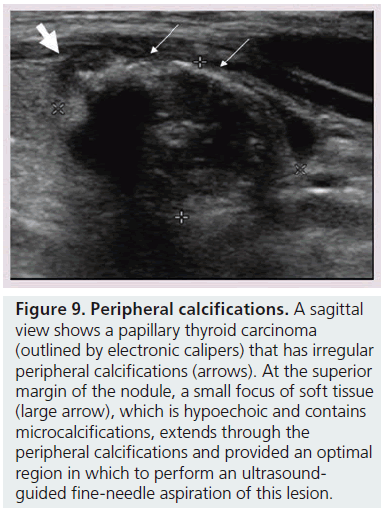 imaging-in-medicine-electronic-calipers