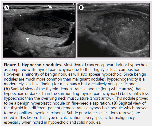 imaging-in-medicine-highly-cellular