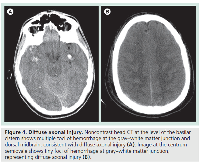 imaging-in-medicine-matter-junction