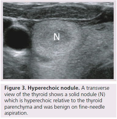 imaging-in-medicine-solid-nodule