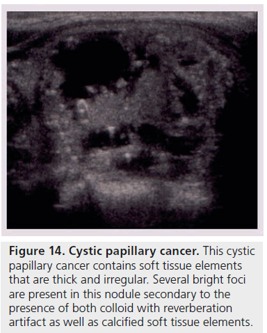 imaging-in-medicine-thick–irregular