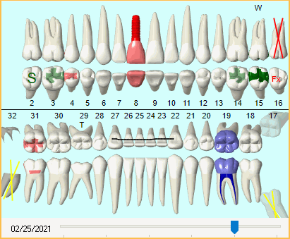 Open Dental Software - Graphical Tooth Chart