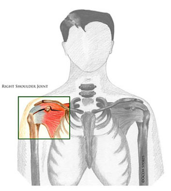 Diagram Of Shoulder Labrum / Slap Tear Orlin Cohen / With most daily ...