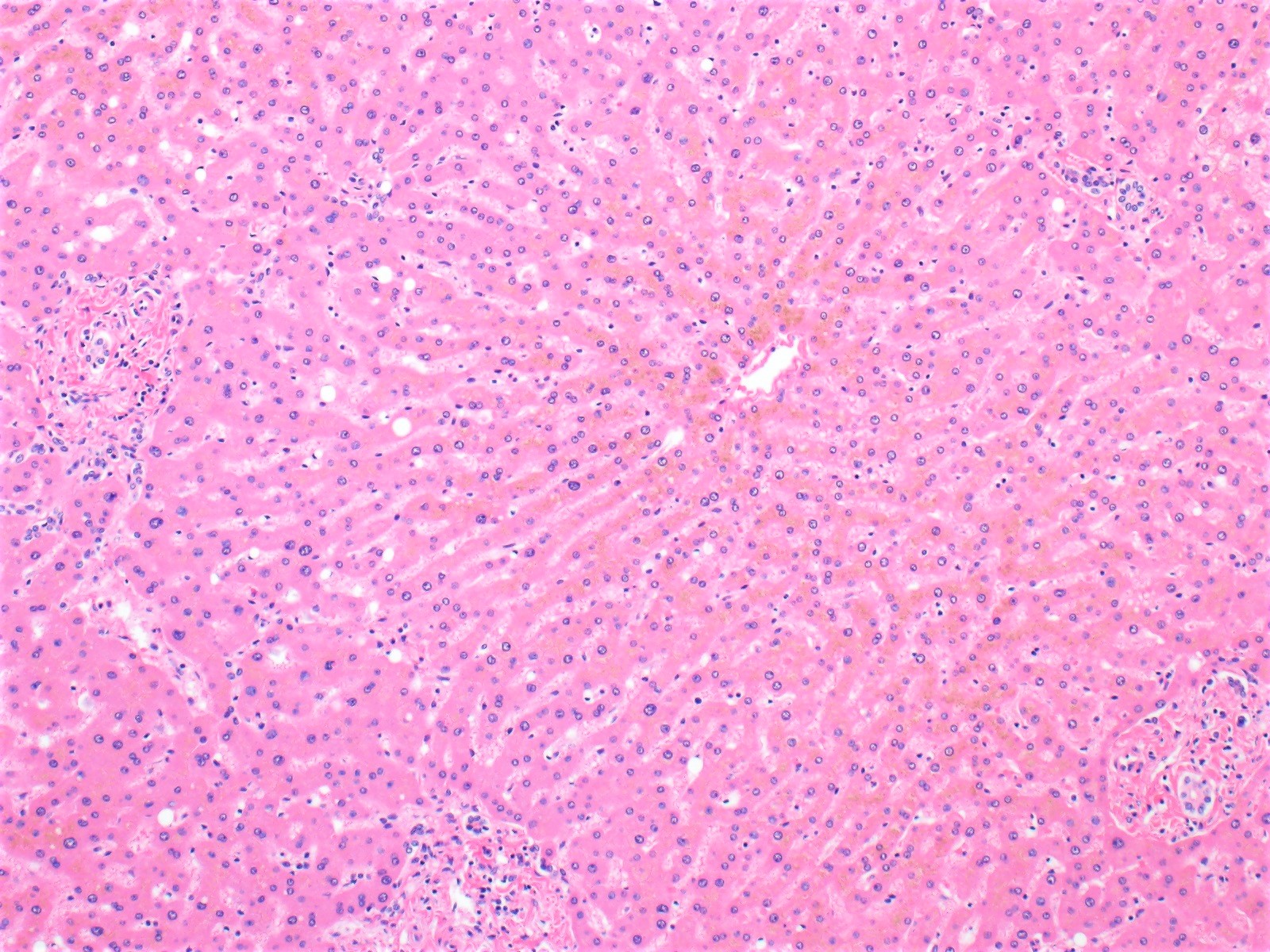 Hepatic Lobule Histology