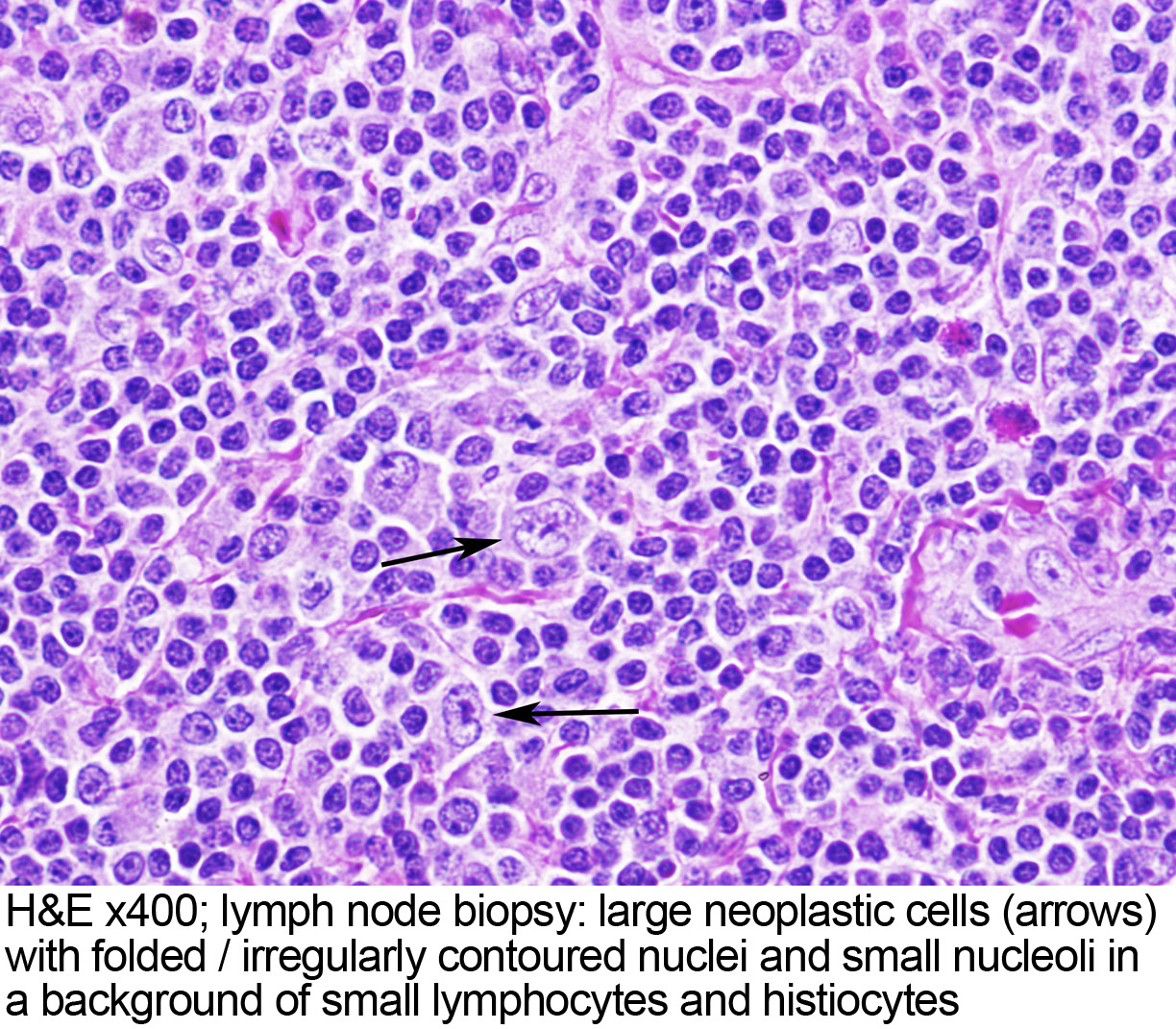 Lymph Node Histology Pathology Outlines