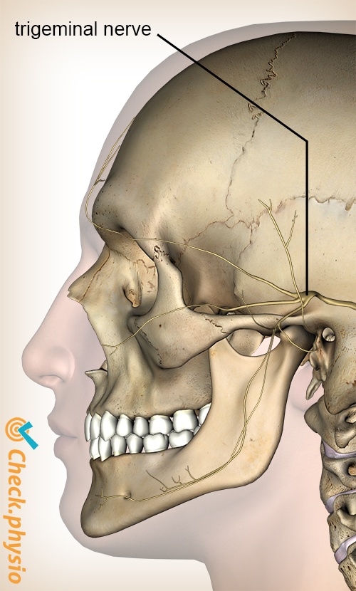 Cervicogenic headache | Physio Check