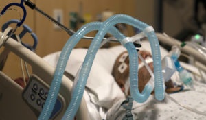 Ventilator tubes are attached a COVID-19 patient at Providence Holy Cross Medical Center in the Mission Hills section of Los Angeles. (AP Photo/Jae C. Hong,File)