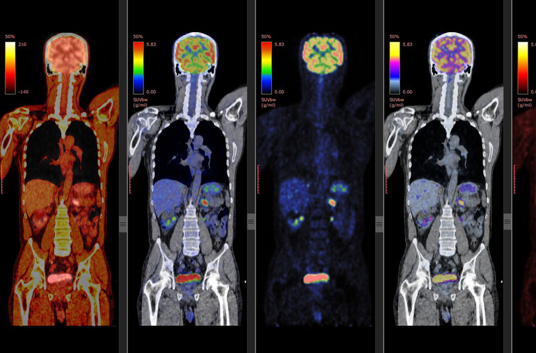 Pet Brain Scan