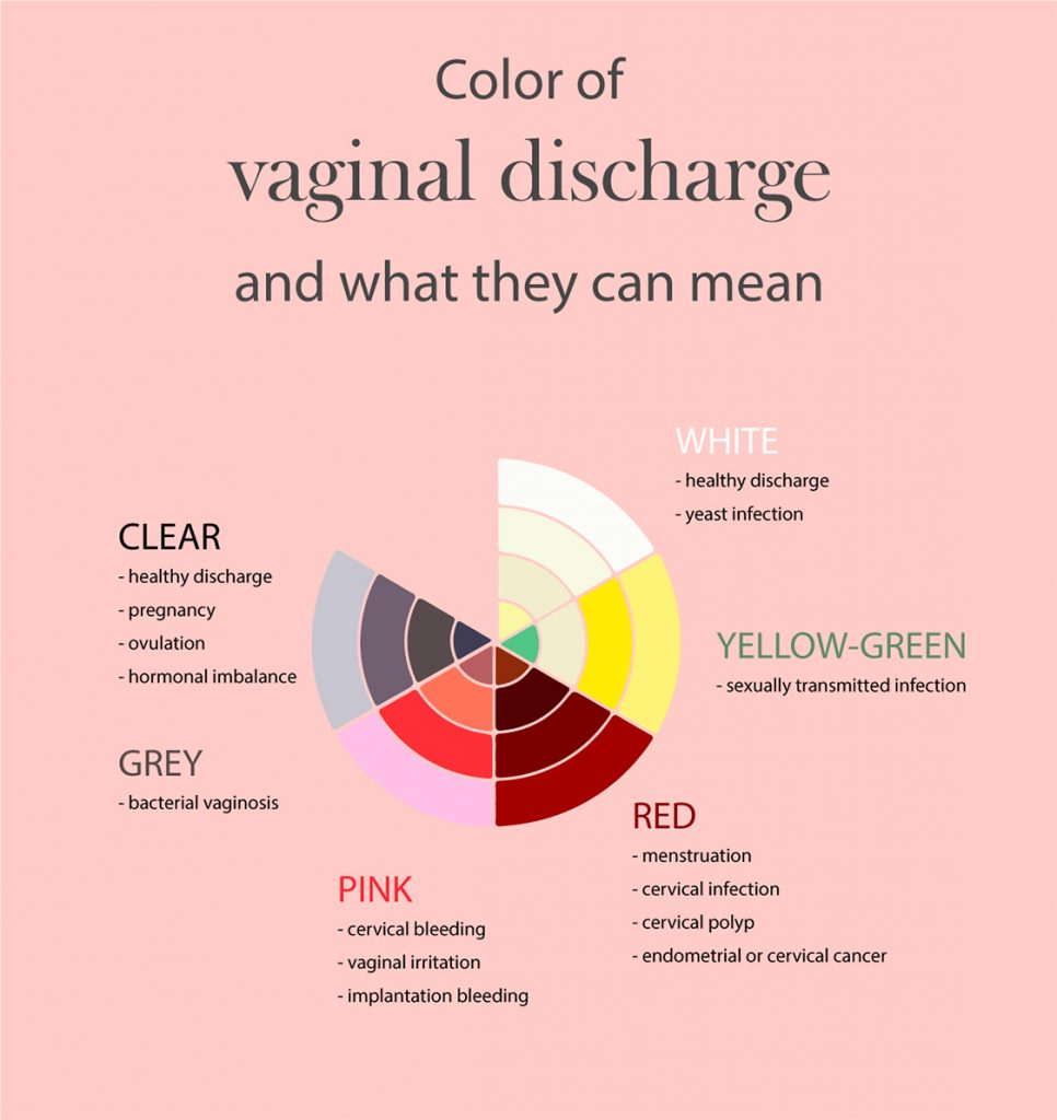 WHAT IS THE COLOR OF YOUR VAGINAL DISCHARGE? IS IT CLEAR, WHITE ...