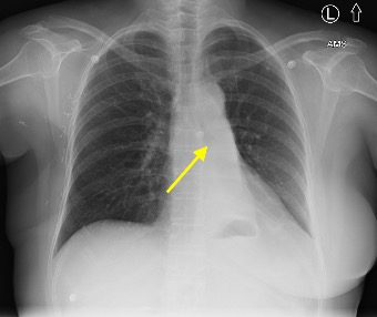 Case of the Month: Department of Radiology: Feinberg School of Medicine ...