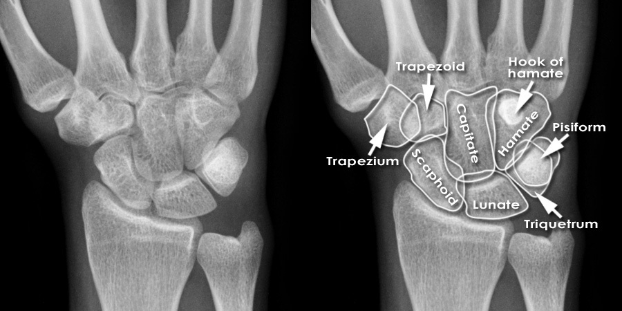 Wrist Anatomy