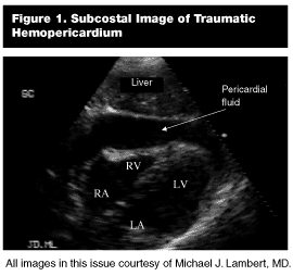 Emergency Ultrasound, Part III: Acute Trauma | 2003-01-27 | AHC…