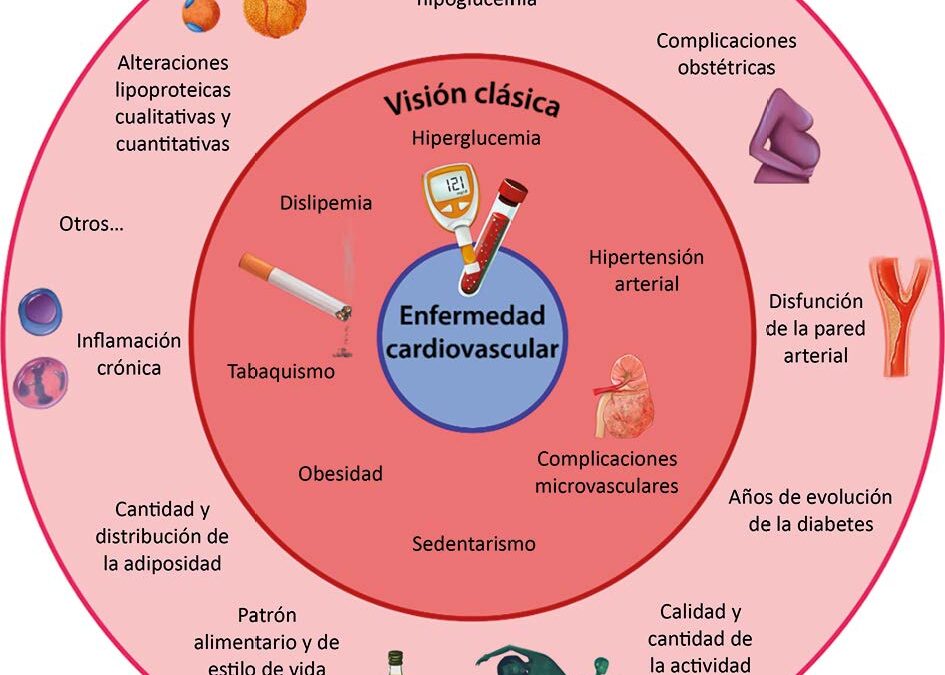 Riesgo cardiovascular en personas con diabetes tipo 1