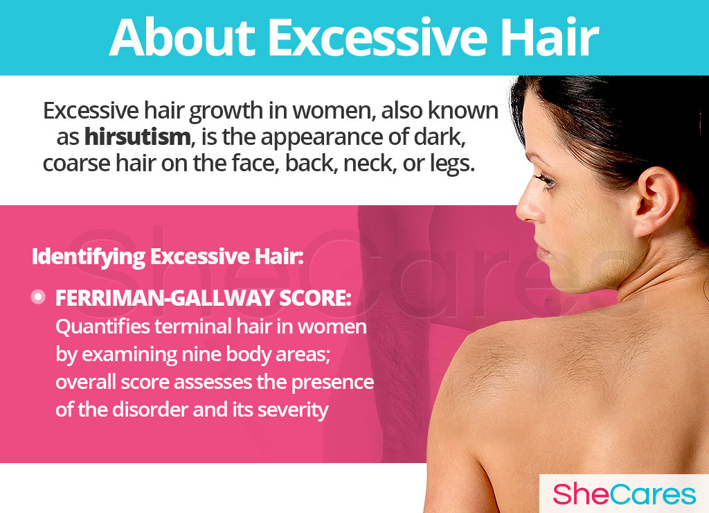 About Excessive Hair