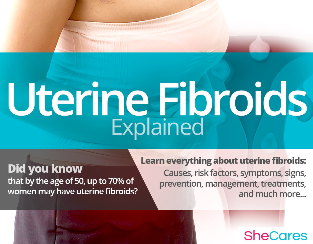 Uterine Fibroids | SheCares