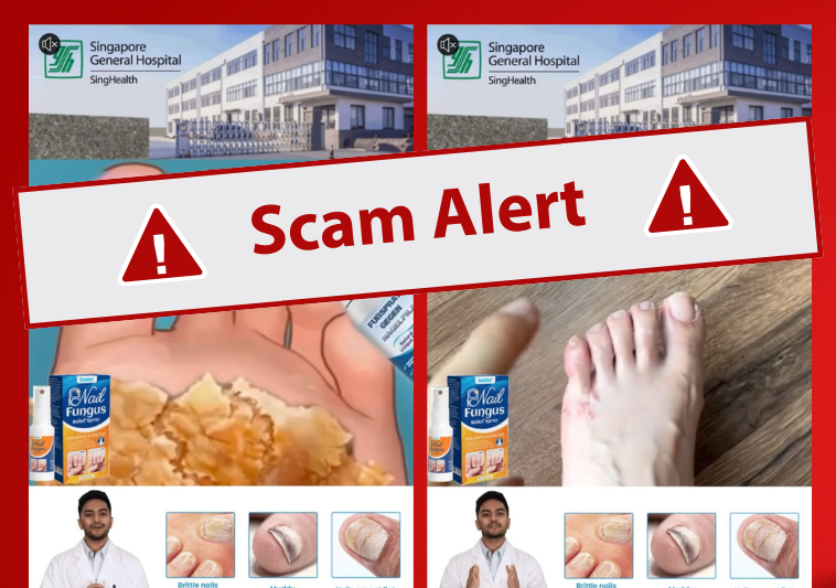 Beware: Fake ads on Nail Fungus spray