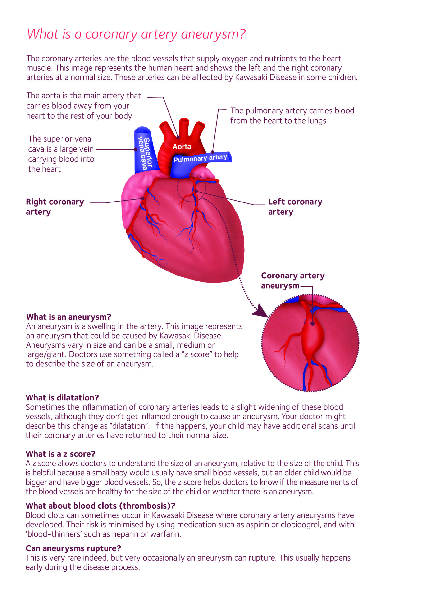 Kawasaki Disease Heart