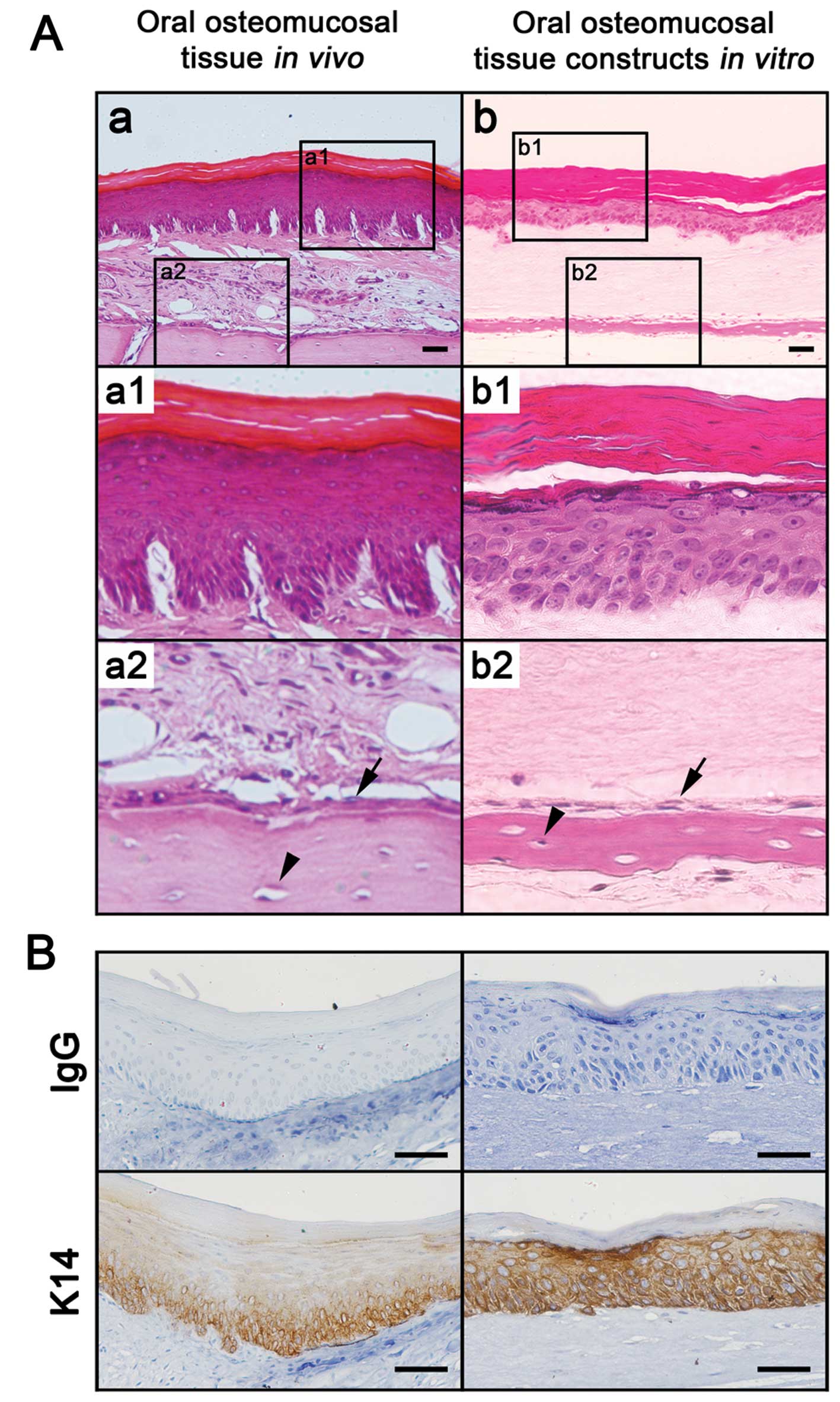 Hard Palate Histology