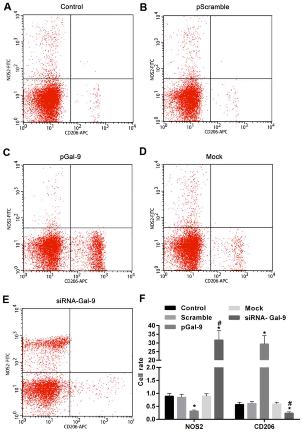 Macrophage M1 M2 Polarization