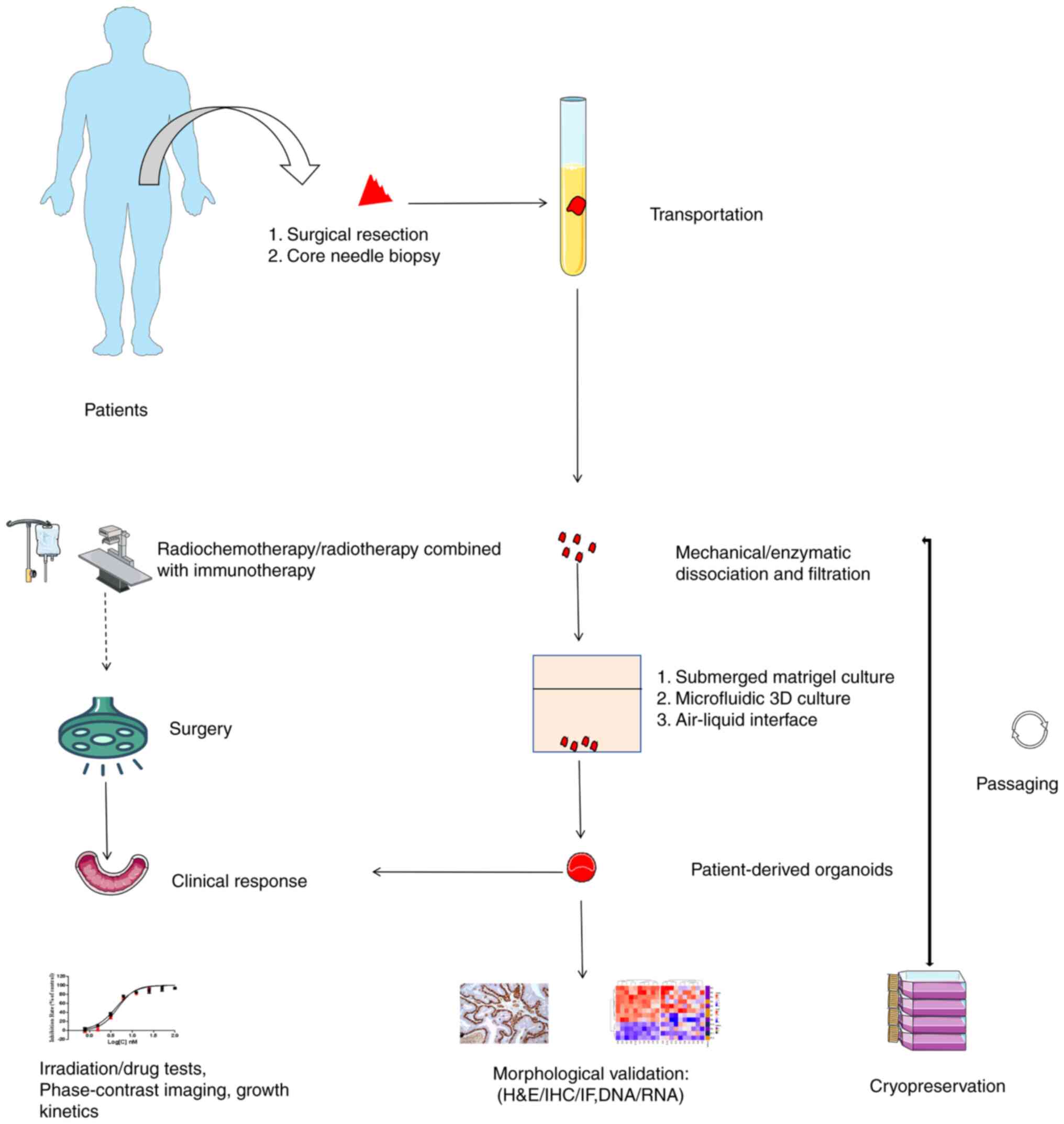 Applications and perspectives of tumor organoids in radiobiology (Review)