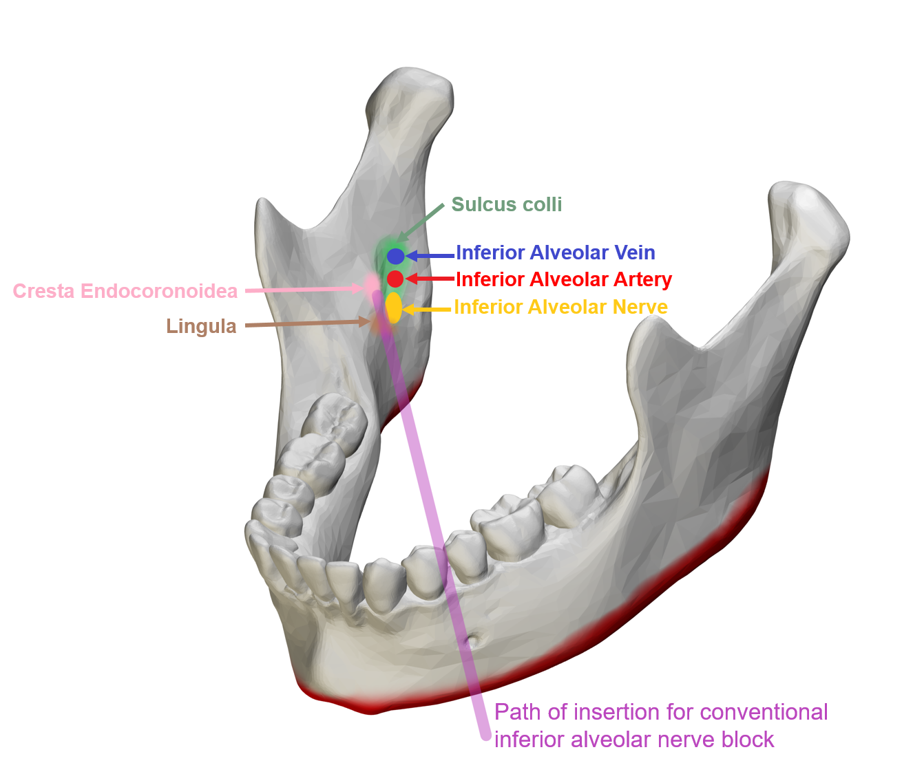 Inferior Alveolar Nerve and Lingual Nerve Injury Article