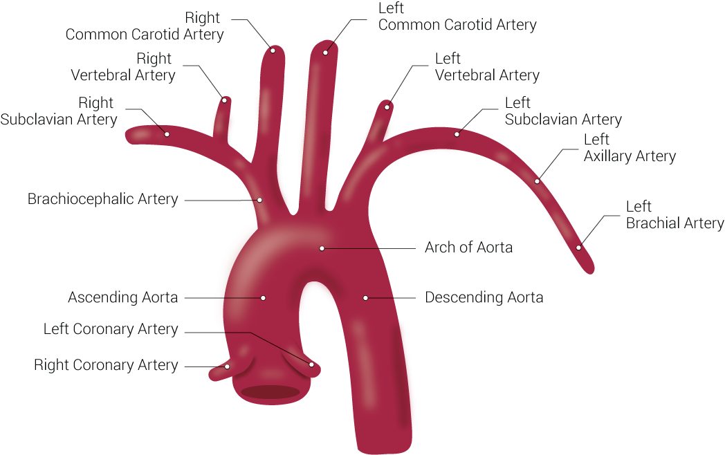 Anatomy, Thorax, Aortic Arch | Treatment & Management | Point of Care