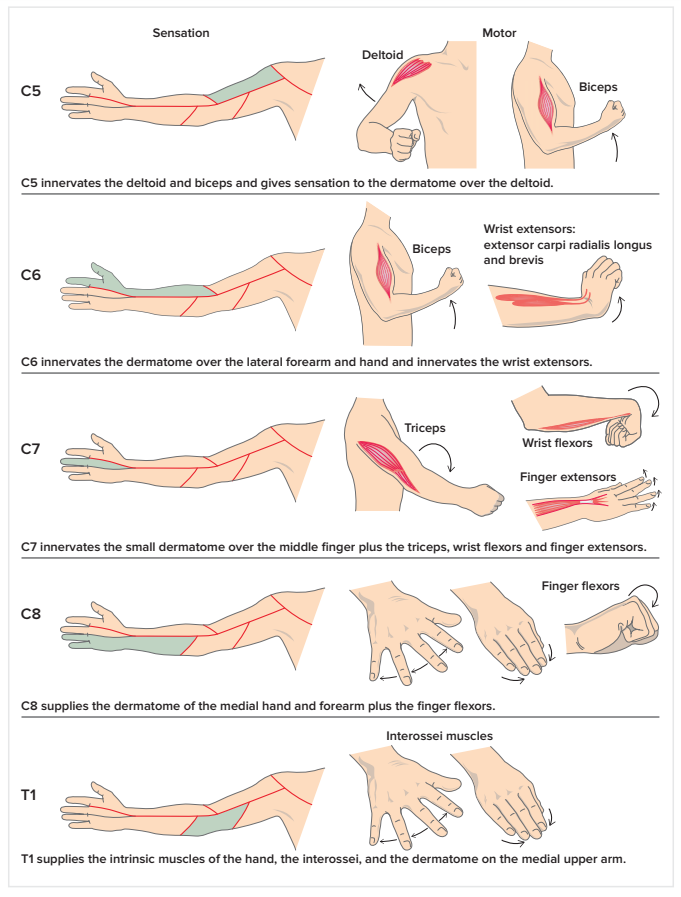 Cervical Radiculopathy Treatment