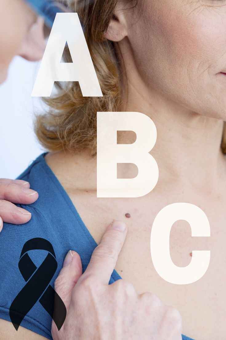 What are the ABCDE's of Skin Cancer – SunLux Skincare