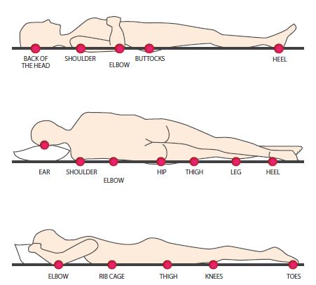 Patient Information & Safety- Pressure Injuries