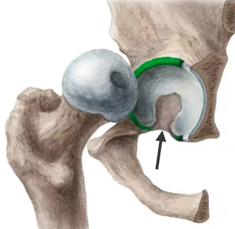 Hip Joint – Bones, ligaments, blood supply and innervation |Anatomy ...