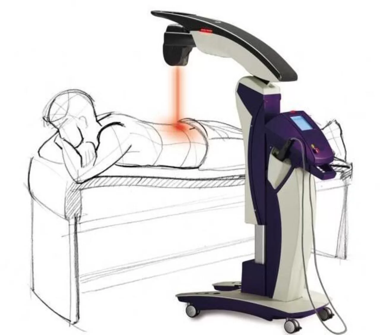 mls laser therapy