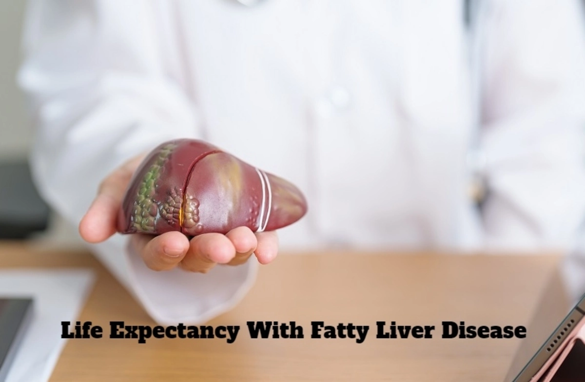 life expectancy with fatty liver disease