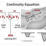 Aortic Valve Area Continuity Equation Calculator